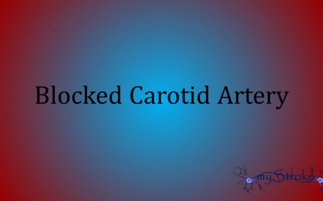 Carotid Occlusion - My Stroke